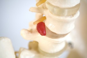 SpineSurgery SpineSurgery